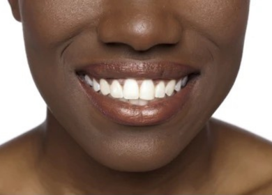 A lady smiling with health teeth.