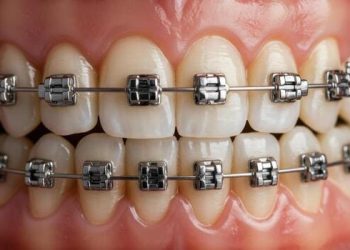 Orthodontics