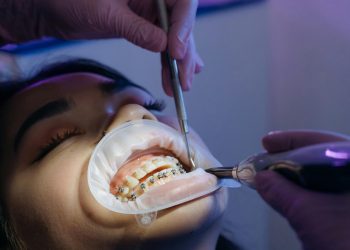 Orthodontics Picture